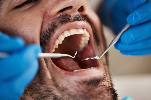 Best Emergency Treatment for Dental Infections or Abscesses in Ecorse, MI