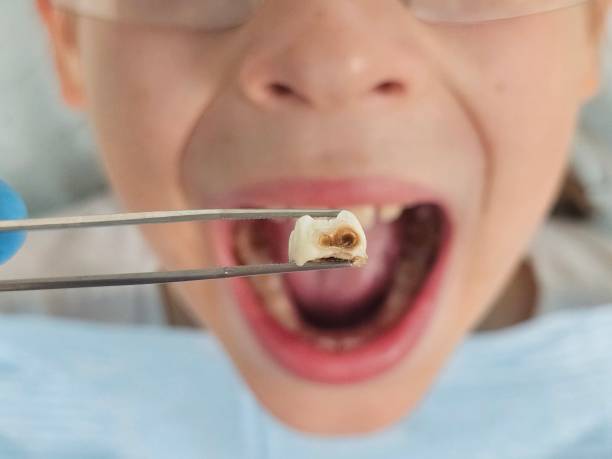 Best Emergency TMJ Treatment in Ecorse, MI