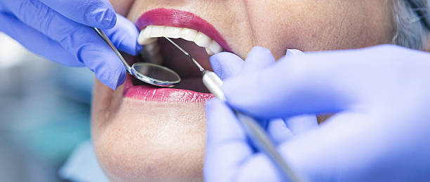 Best Emergency Treatment for Dental Infections or Abscesses in Ecorse, MI